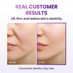 BIOHEAL BOH Probioderm 3D Lifting Cream
